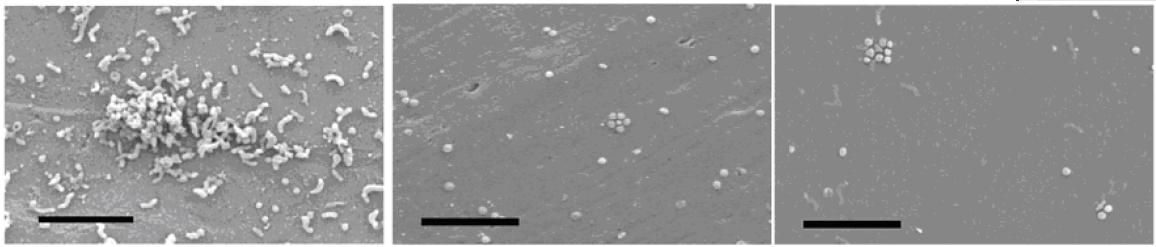 Observation au microscope électronique à balayage des cellules d’Helicobacter pylori fixées après 192 heures au cuivre (image du haut), au PVC (image du milieu) et au verre (image du bas)